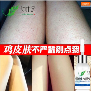 淘宝上的长高药有用吗_药上写的哺乳期忌用_用手机在淘宝上怎么注册账号