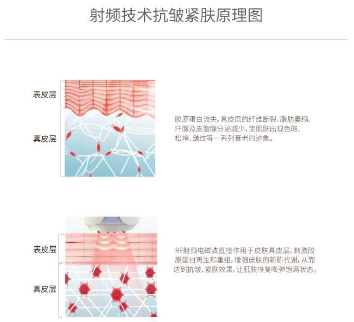 做鸡肉卷的饼皮有卖吗_做电波拉皮有什么功能_电波拉皮的好处