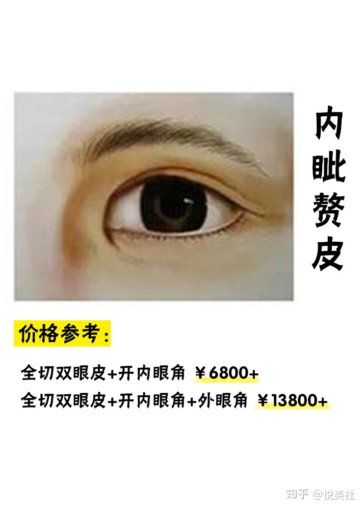 开双眼皮需要多少钱啊_开眼角和双眼皮的恢复期是多久_南京开双眼皮的医院好