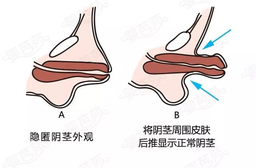 什么药延长性爱时间_买什么药可以延长性生活的时间_什么药吃了能延长性爱时间