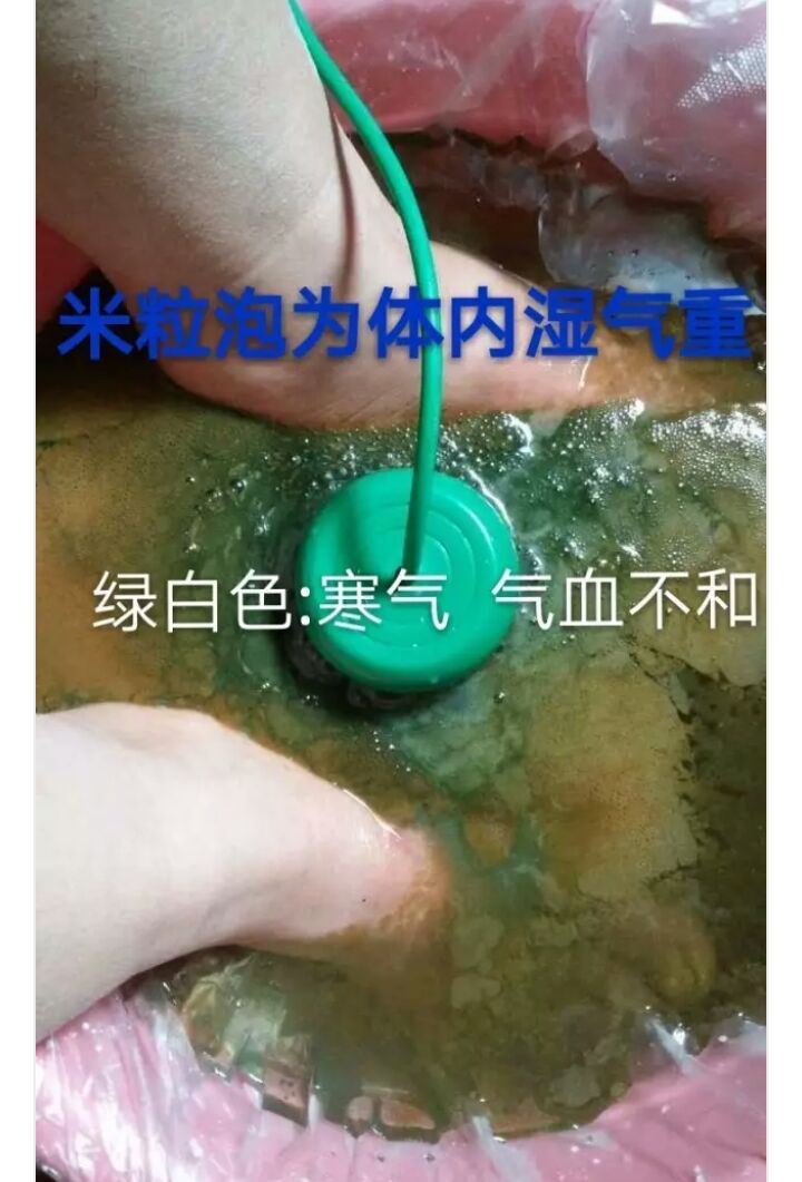 水是故乡甜阅读_去红血丝是薇姿好还是森田药妆好_水是最好的药在线阅读