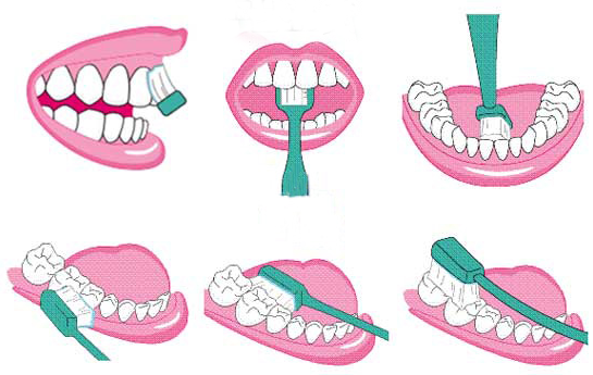 合成皮革脱层_苏州牙博士口腔_每次刷完牙口腔内都要脱一层皮是什么原因呢