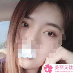 阜新美容院谁家做双眼皮好啊_浙江哪里做美容冠好_做美容加盟哪个牌子好