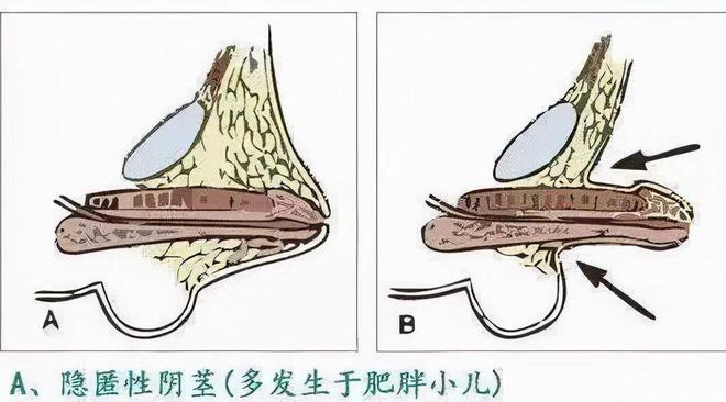 增大变粗调情进口生活用品_14男孩增大増粗图片_进口生活用品进口母婴用品