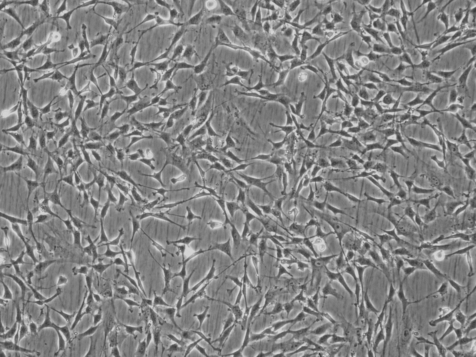 番茄果肉细胞镜像图_标价镜检上皮细胞少_tct检查无颈管细胞