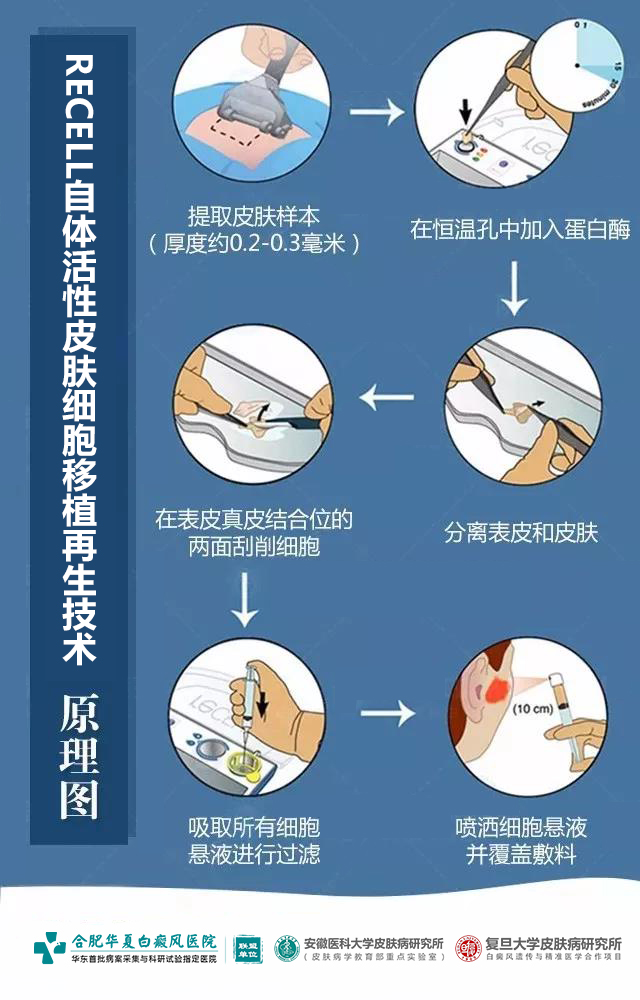 打瘦脸针要注意事项_打瘦脸针注意哪些事项_水光针打好后注意事项