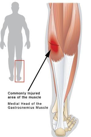 运动膝盖损伤如何修复_体育运动中预防运动损伤意义_体育运动中预防运动损伤意义