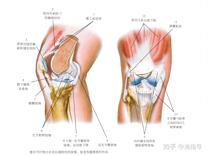 膝盖疼打软腿怎么办_膝盖软骨膜损伤_膝盖发软是什么原因