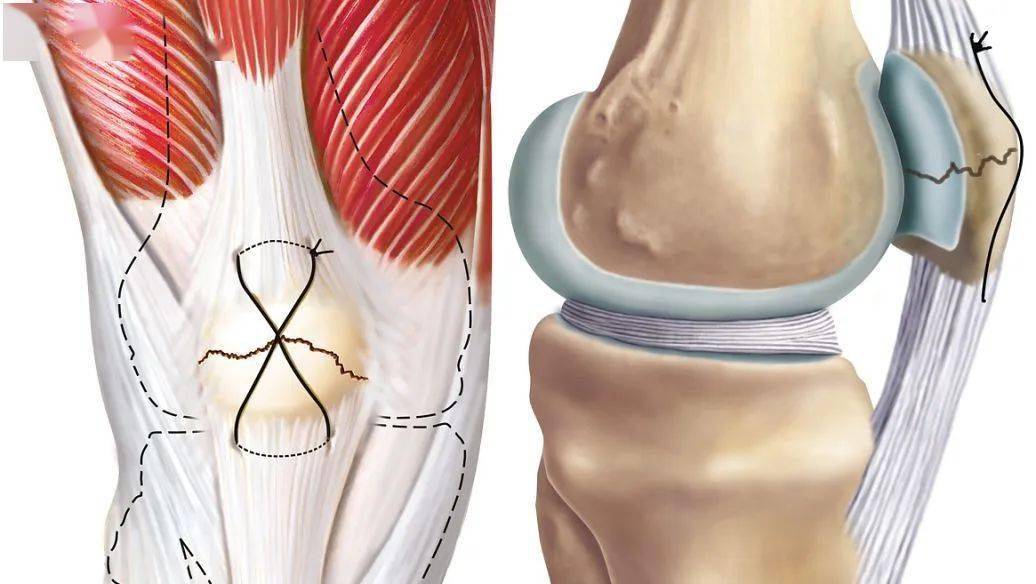 膝盖锻炼最好的方法_保护膝盖的锻炼方法_膝盖疼锻炼方法