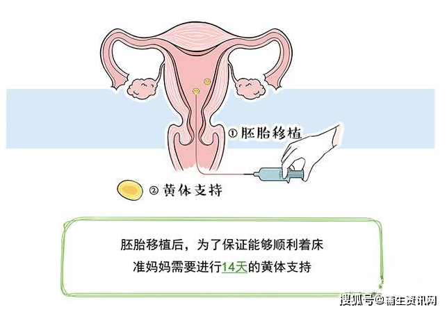 锻炼好身体吃什么_散步能锻炼身体吗_锻炼酸疼能继续锻炼吗