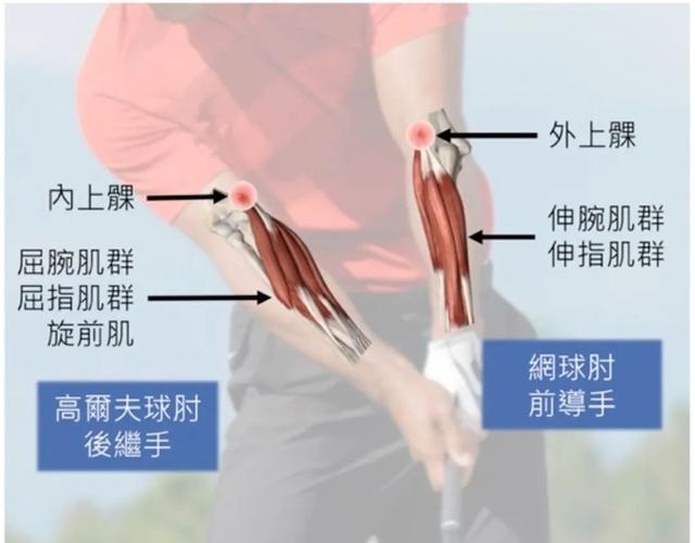 膝盖运动方法_保护膝盖的运动方法_保护膝盖的运动