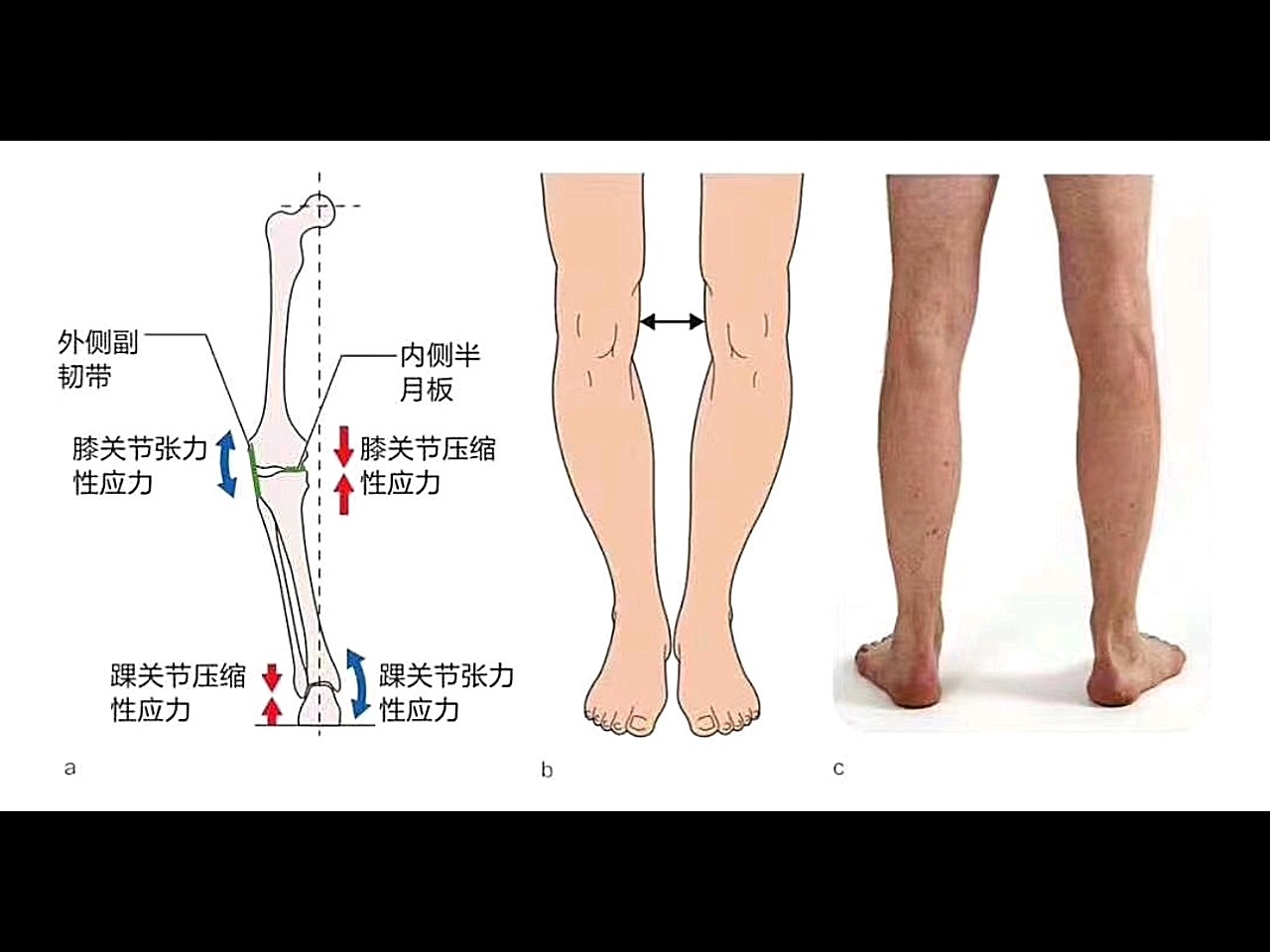 运动怎么保护膝盖_如何保护膝盖关节_保护膝盖的运动方法