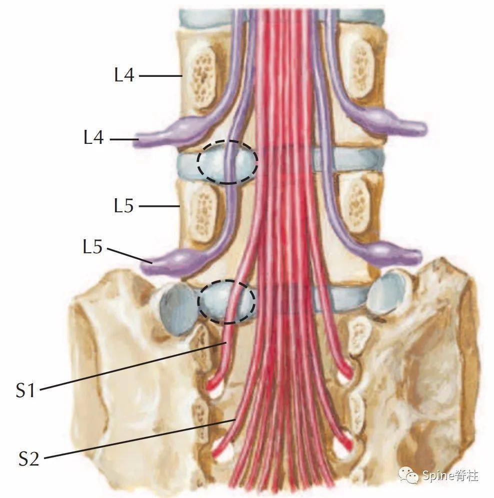 腰椎间盘突出间管狭窄怎么样治疗_腰椎间盘怎么锻炼图片_腰椎锻炼恢复强直性脊柱炎图片