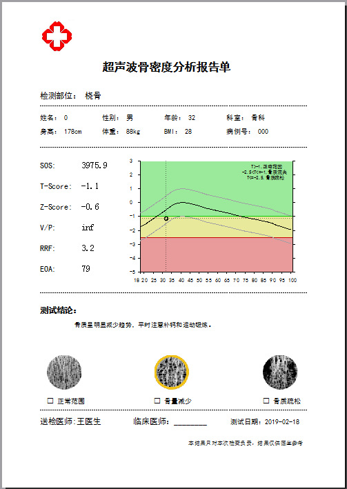 神经网络算法预测例子与代码_神经网络预测r程序_神经网络做预测的原理