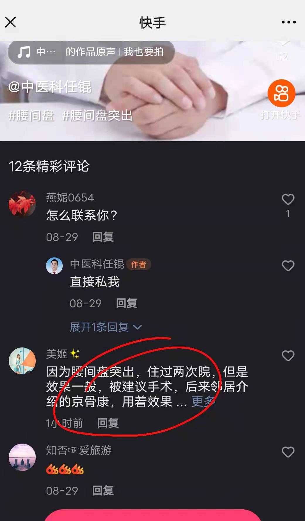 快手平台点赞的赞美之词_快手上怎么给人点赞_快手点赞人员