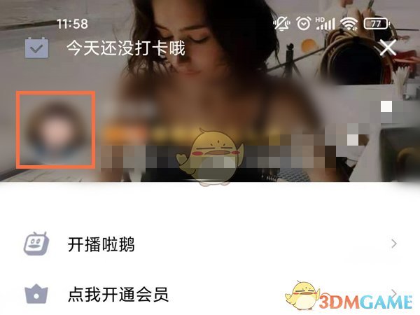 快手获赞一元一百_快手获赞有什么作用_快手获得赞有钱吗